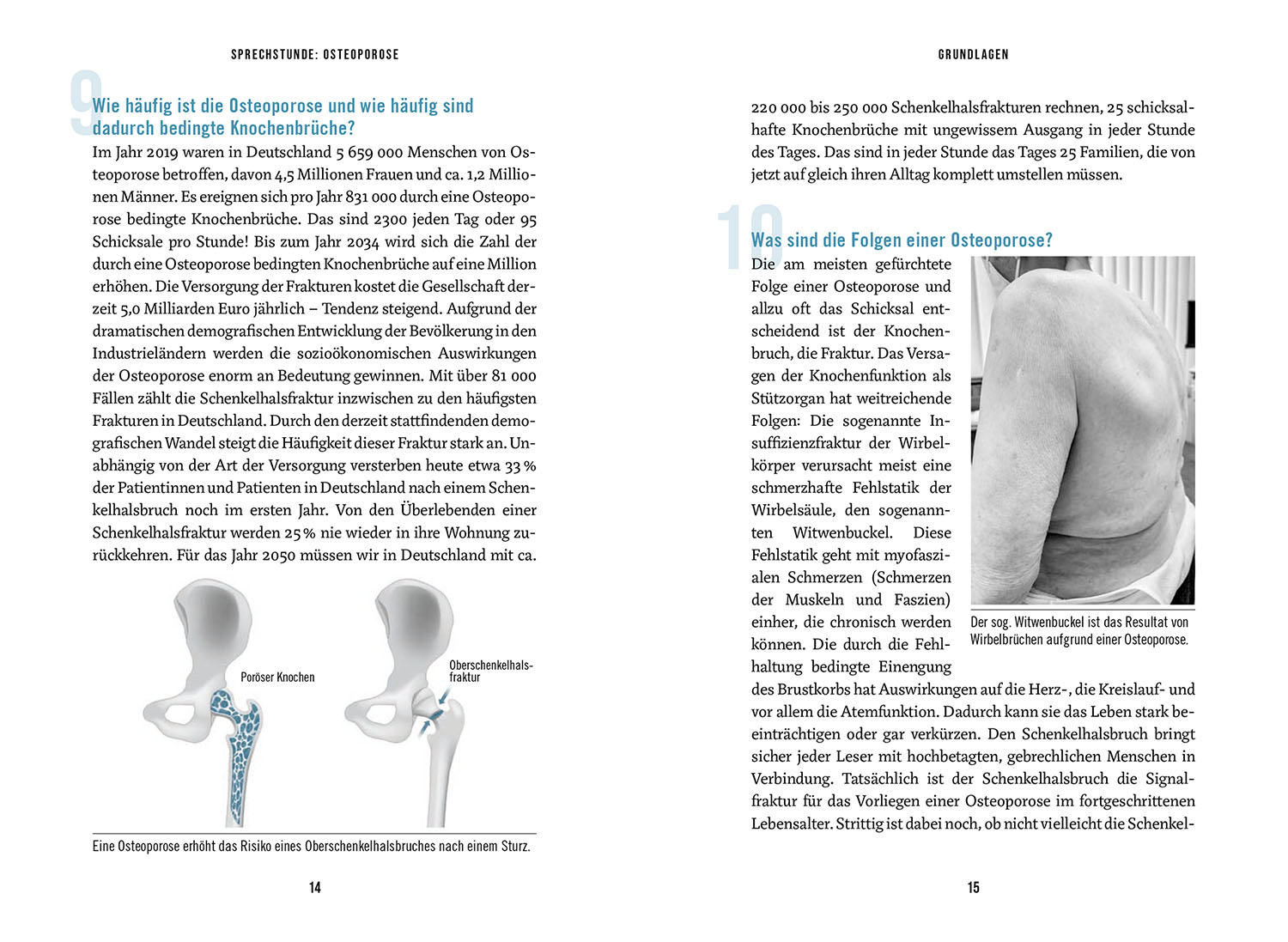 In der Sprechstunde: Osteoporose