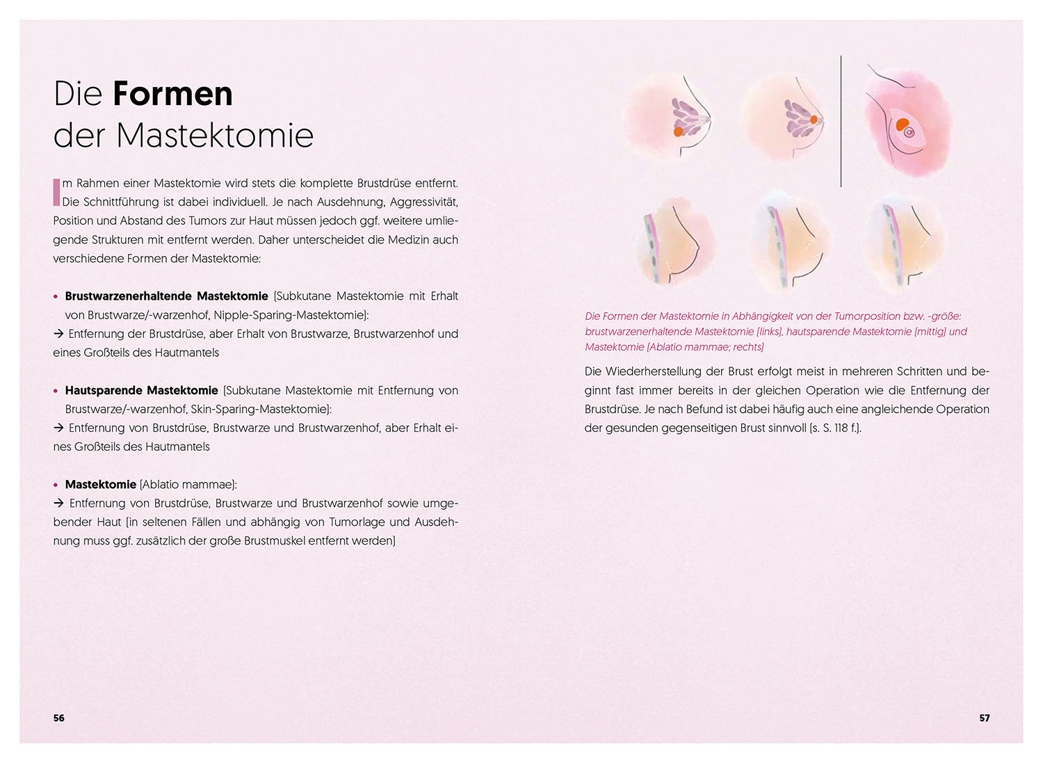 Diagnose Brustkrebs