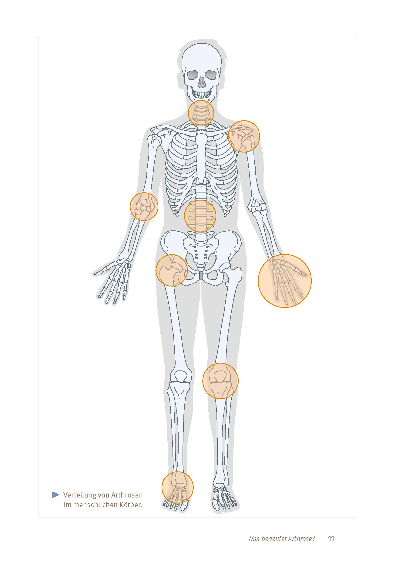 Expertenwissen: Arthrose